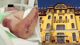 Čech se vážně zranil při pádu z hotelu v Tatrách.