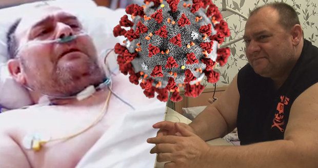 „Nemůžu si ani utřít zadek,“ říká po půl roce pražský taxikář (53), nejznámější nakažený koronavirem
