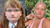 Dívka, která se nemůže smát: Kvůli vzácné nemoci chtěla několikrát spáchat sebevraždu, dnes je z ní modelka