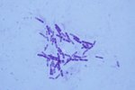 Mycobacterium tuberculosis - bakterie způsobující tuberkolózu.