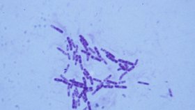 Mycobacterium tuberculosis - bakterie způsobující tuberkolózu.