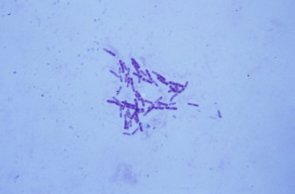 Mycobacterium tuberculosis - bakterie způsobující tuberkolózu