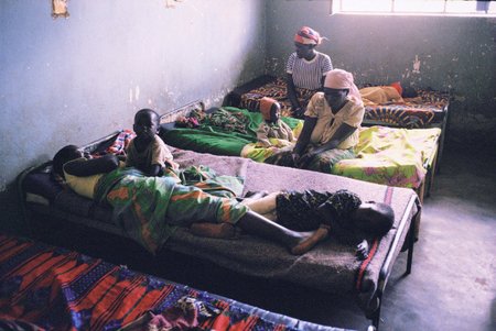 Především v rozvojových zemích světa trpí lidé společně s TBC také na virovou infekci HIV