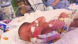 Nejmladší pacient s koronavirem: Miminko se narodilo nakažené
