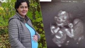 Neuvěřitelný příběh Pavlíny Maťhové (31) ze Sokolova: Rakovině vzdoruje i v těhotenství!