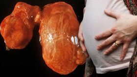 Těhotné ženy by měly požádat o vyšetření funkce štítné žlázy