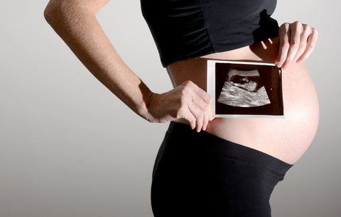 Nezdařený potrat: V 5. měsíci zjistila, že je stále těhotná