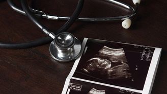 Zákaz potratu, když plodu tluče srdce. Stát Iowa posunul USA blíž ke konzervativní revoluci