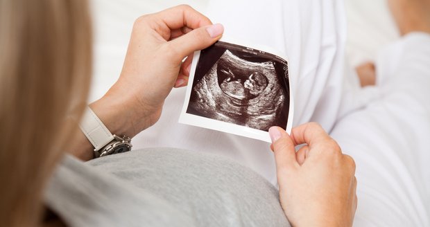 Mnohočetná těhotenství jsou u lidí poměrně zvláštním úkazem