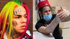 Tekashi 6ix9ine si zlomil zápěstí.