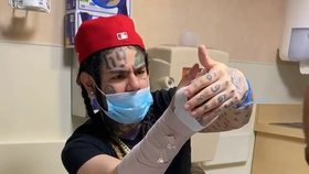 Kontroverzní rapper Tekashi 6ix9ine skončil v nemocnici poté, co si zlomil zápěstí.