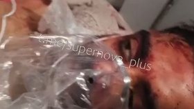 Drama na palubě letu do Tel Avivu: O zraněného pilota se postarali pasažéři
