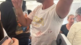 Yaniv Hayoun věděl, jak se zachovat, díky televiznímu pořadu