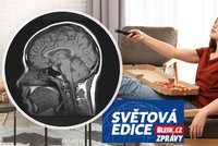 Sledování televize odbourává šedou kůru. K demenci se počítá každá hodina denně