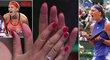 Tenistka Petra Kvitová nemůže kvůli jizvám na prstech slavit jako dřív. Tady je důkaz!