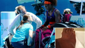 I s tímhle zraněním dokázala Serena Williams odehrát čtvrtfinále Australian Open.