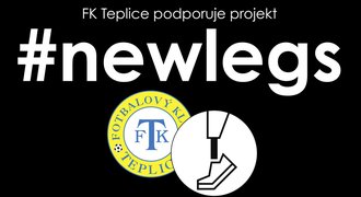 Zápas Plzně v Teplicích podpoří charitativní projekt #newlegs