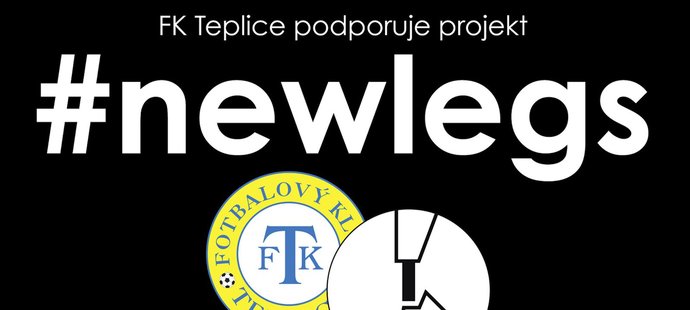 Teplice podpoří charitativní projekt