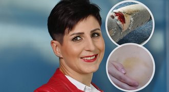 Šokující zážitky reportérky Kubíčkové: Krvavý útok fanoušků a rána do prsu!