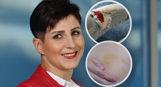 Šokující zážitky reportérky Kubíčkové: Krvavý útok fanoušků a rána do prsu! Šokující zážitky reportérky Kubíčkové: Krvavý útok fanoušků a rána do prsu!