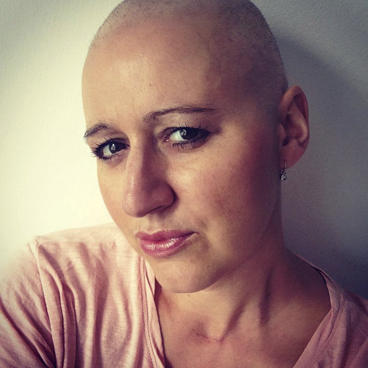 Tereza musela podstoupit chemoterapii.
