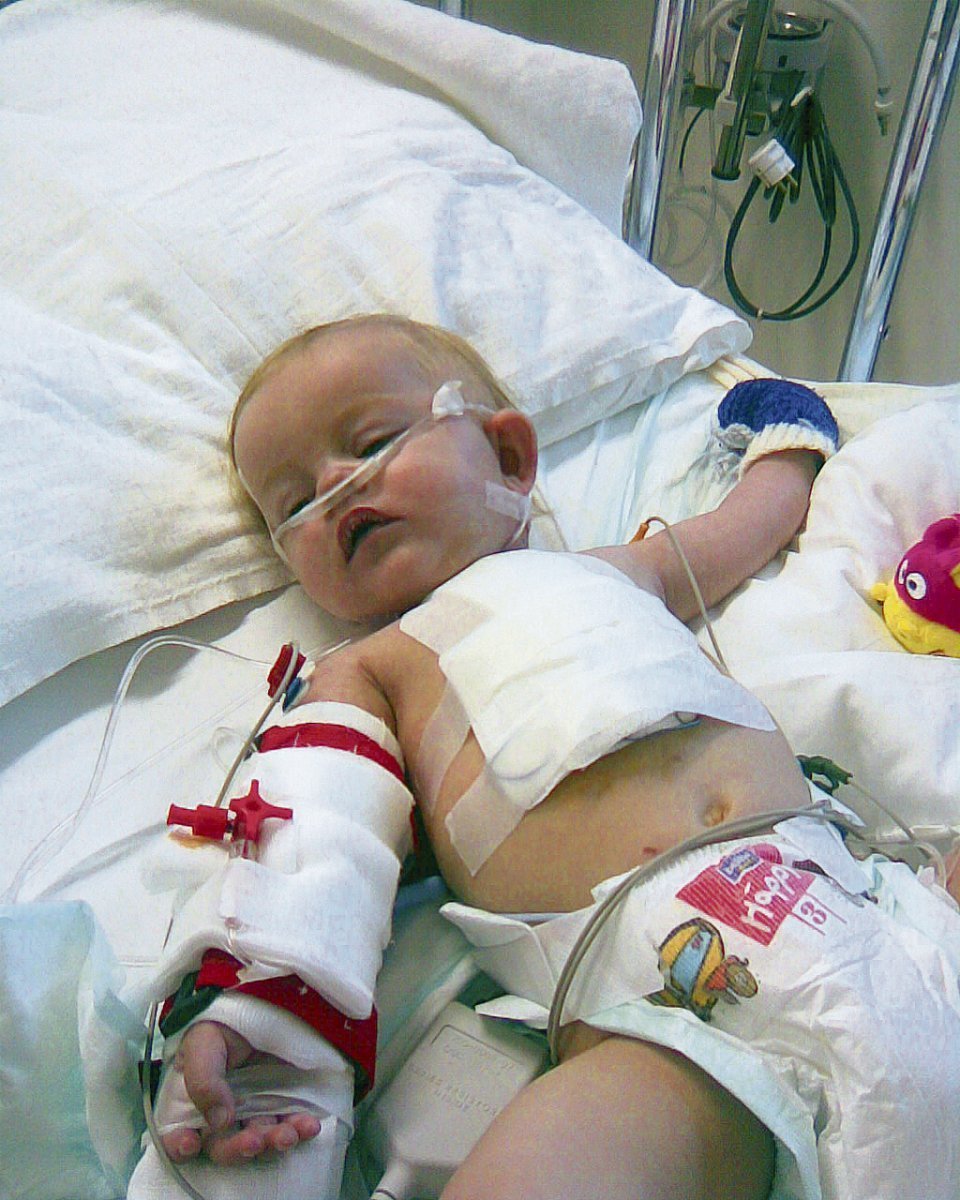 Takhle Terezka trpěla po operaci srdce pár dnů po narození
