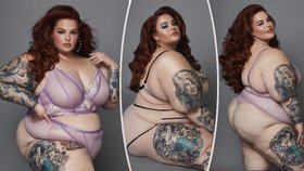 Obézní modelka přiznala: Bojuji s anorexií!