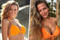 Tess z Love Islandu přiznala plastiku prsou: Impulzivní rozhodnutí!