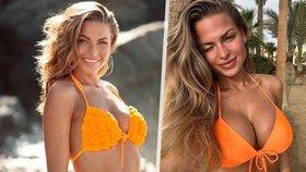 Tess z Love Islandu přiznala plastiku prsou: Impulzivní rozhodnutí!