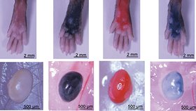 Díváte se na srovnání toho, jak vypadá zdravá kůže a uzlina (vlevo) ve srovnání s těmi obarvenými tetovacím inkoustem (zprava zelený, červený a černý). Zbarvení je 2 měsíce po tetování. Výzkum byl prováděn na myších