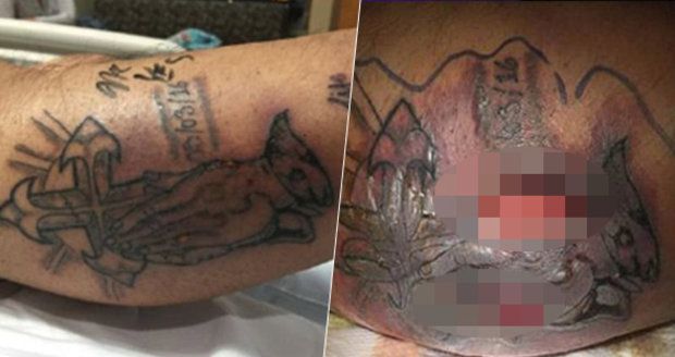 Zabilo ho tetování! Muž (†31) nedbal na varování, že se s čerstvou ozdobou těla nemá koupat