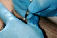 HIV pozitivní obvinil špitál: Dostal ale nemoc z tetování?