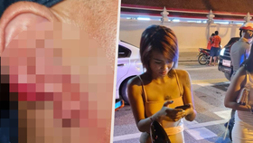Prostitutka ukousla šokovanému turistovi kus ucha!
