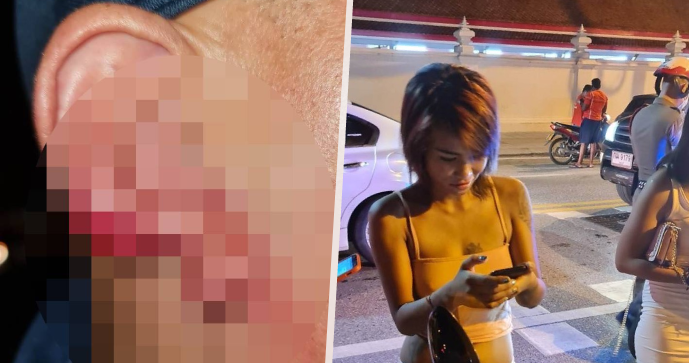 Prostitutka ukousla šokovanému turistovi kus ucha!