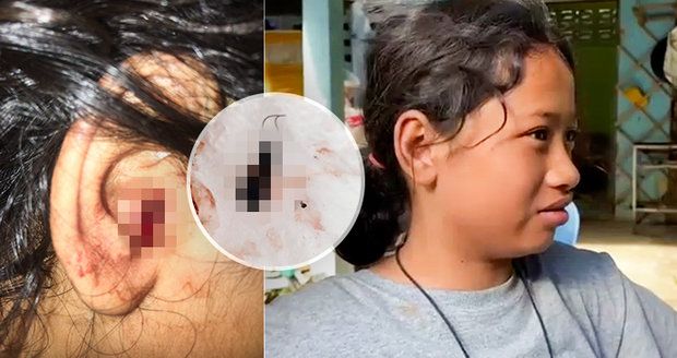Školačku (12) napadl agresivní brouk! Žil jí v uchu dva dny!