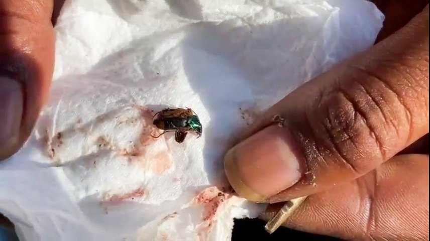 Hmyz, který měla dívka v uchu.
