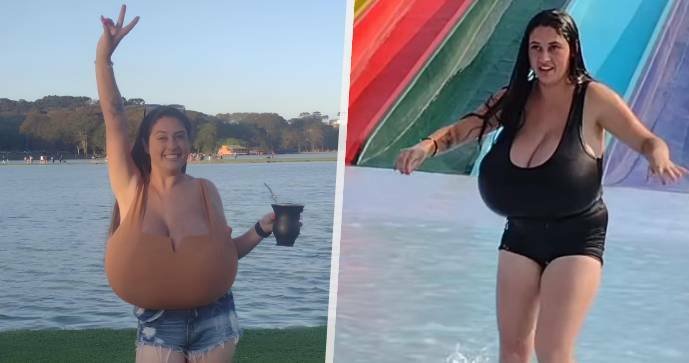 Thaynara Marcondes (22) trpěla extrémní formou vzácného onemocnění zvaného gigantomastie.