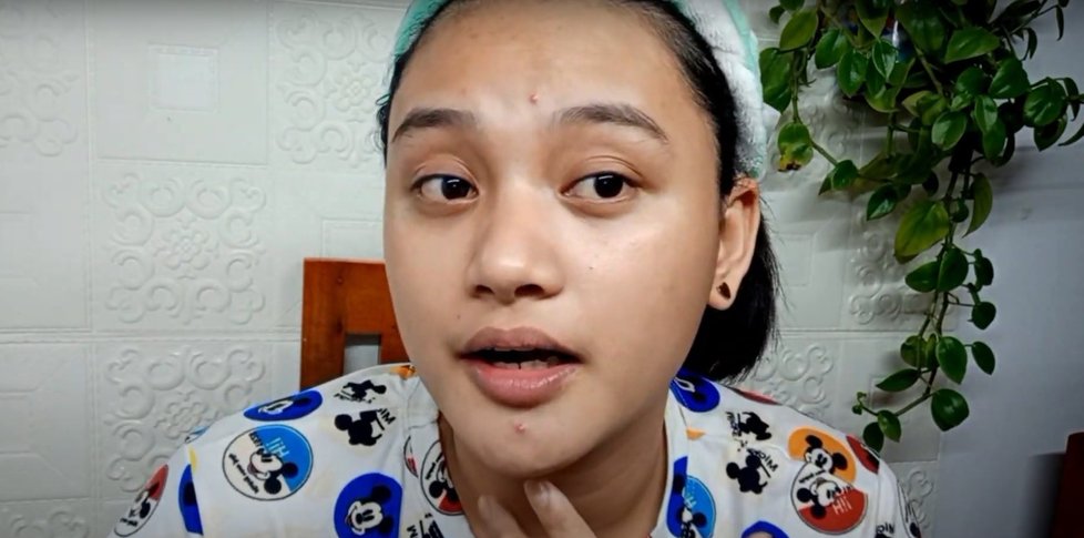 Youtube Thess z Filipín ve videu ukázala, jak si na akné dává vlastní moč.