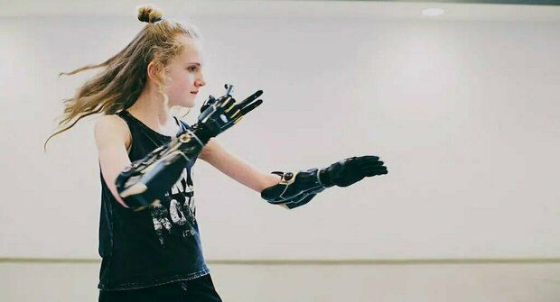 Dívka s bionickýma rukama: Tohle není sci-fi!