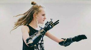Dívka s bionickýma rukama: Tohle není sci-fi!