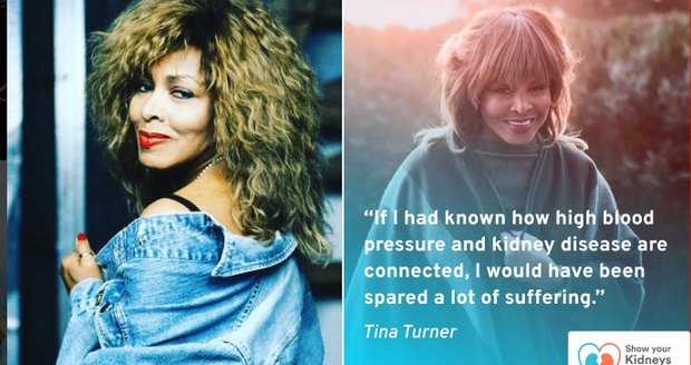 Tina Turner se rozepsala o svých ledvinách.