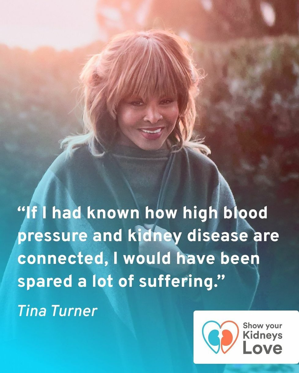Tina Turner se rozepsala o svých ledvinách