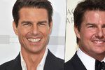 Tom Cruise to trochu přehnal s botoxem!