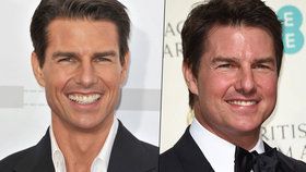 Co to má Tom Cruise s tváří? Mission: Botox-ible?