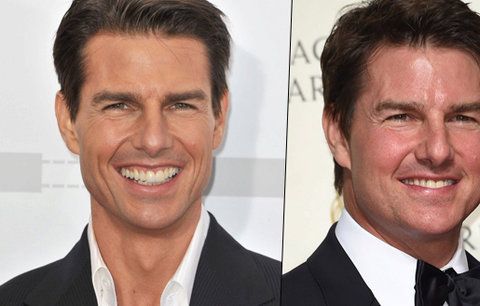 Co to má Tom Cruise s tváří? Mission: Botox-ible?