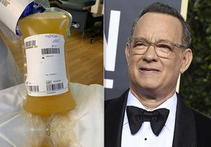 Tom Hanks daroval vědcům kus sebe - plazmu s protilátkami