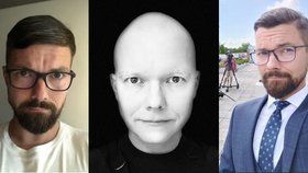 Exmoderátor ČT Drahoňovský k nepoznání: Alopecie mu vzala vlasy, vousy, obočí i řasy