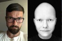 Alopecií stižený exmoderátor ČT Tomáš Drahoňovský: Strach, jak by v televizi působil bez vlasů