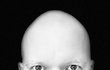 Tomáš Drahoňovský, bývalý moderátor ČT, sdílel fotky ze své proměny vlivem nemoci zvaná alopecie