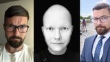 Alopecií stižený exmoderátor ČT Tomáš Drahoňovský: Strach, jak by v televizi působil bez vlasů